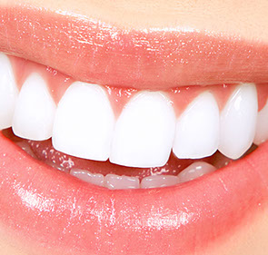 teeth_whitening_newcastle