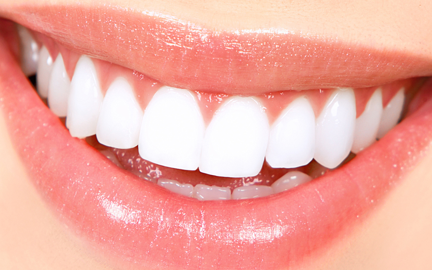 teeth_whitening_newcastle